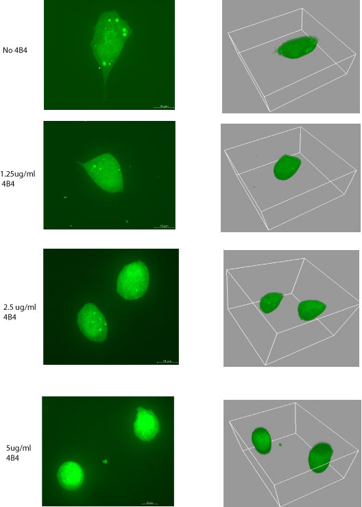 Реальное изображение клеток (слева) и их трехмерная модель (справа) при увеличении (сверху вниз) концентрации в культуральной среде антител к интегрину (иллюстрации с сайта www.cbio.ru)