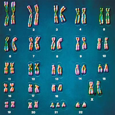 Человеческие хромосомы