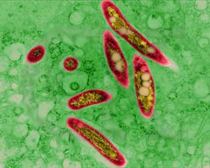 Мікобактерії (Mycobacterium tuberculosis - червоно-жовтий колір) у тканинах людини (ілюстрація з сайту:www.primer.ru)